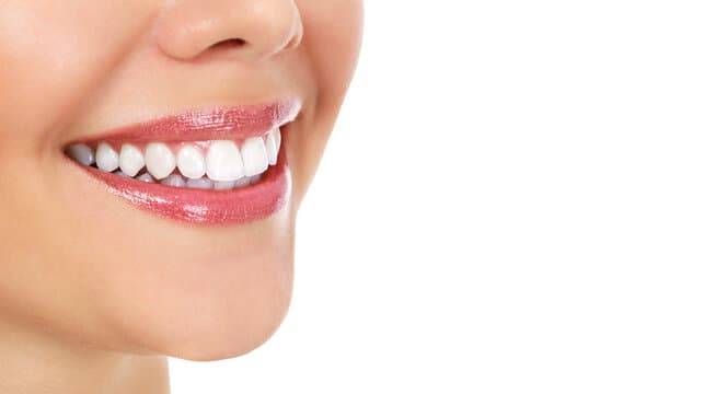 Bright, healthy smile after premium cosmetic dentistry at Elite Smile Clinic Dubai